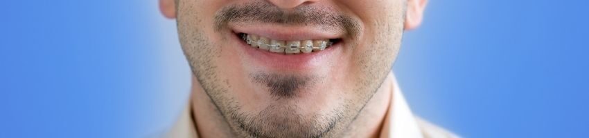 A man suffering from braces stains.