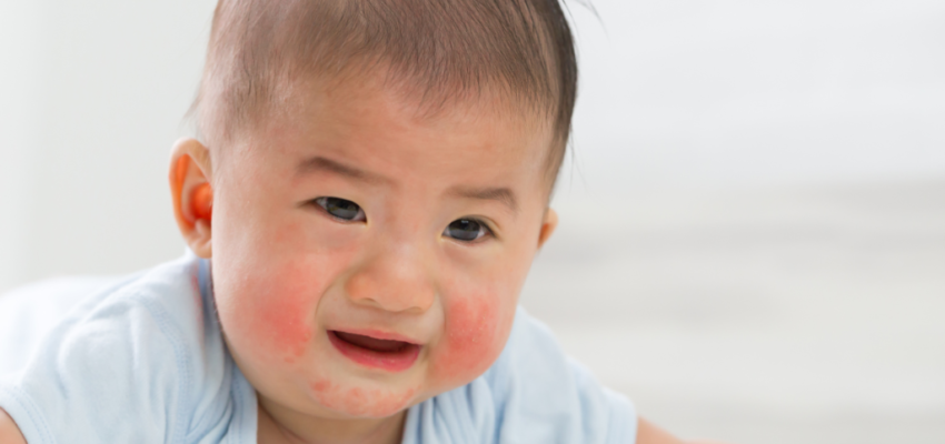 A woman smiling after her mouth sore was treated.