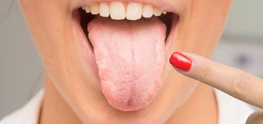 The woman checks if she has signs of oral thrush.