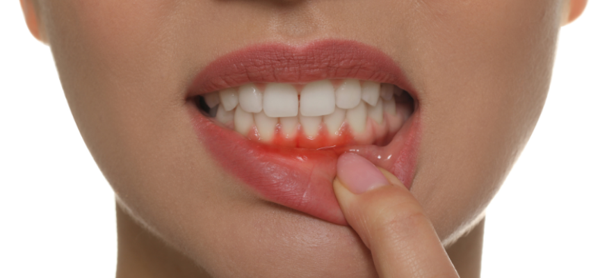 A woman is experiencing throbbing gum pain.