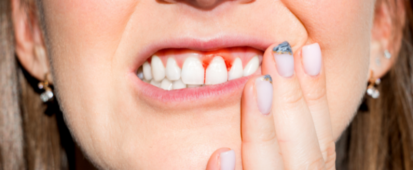 A woman eating sweet foods to get rid of salty taste in mouth.