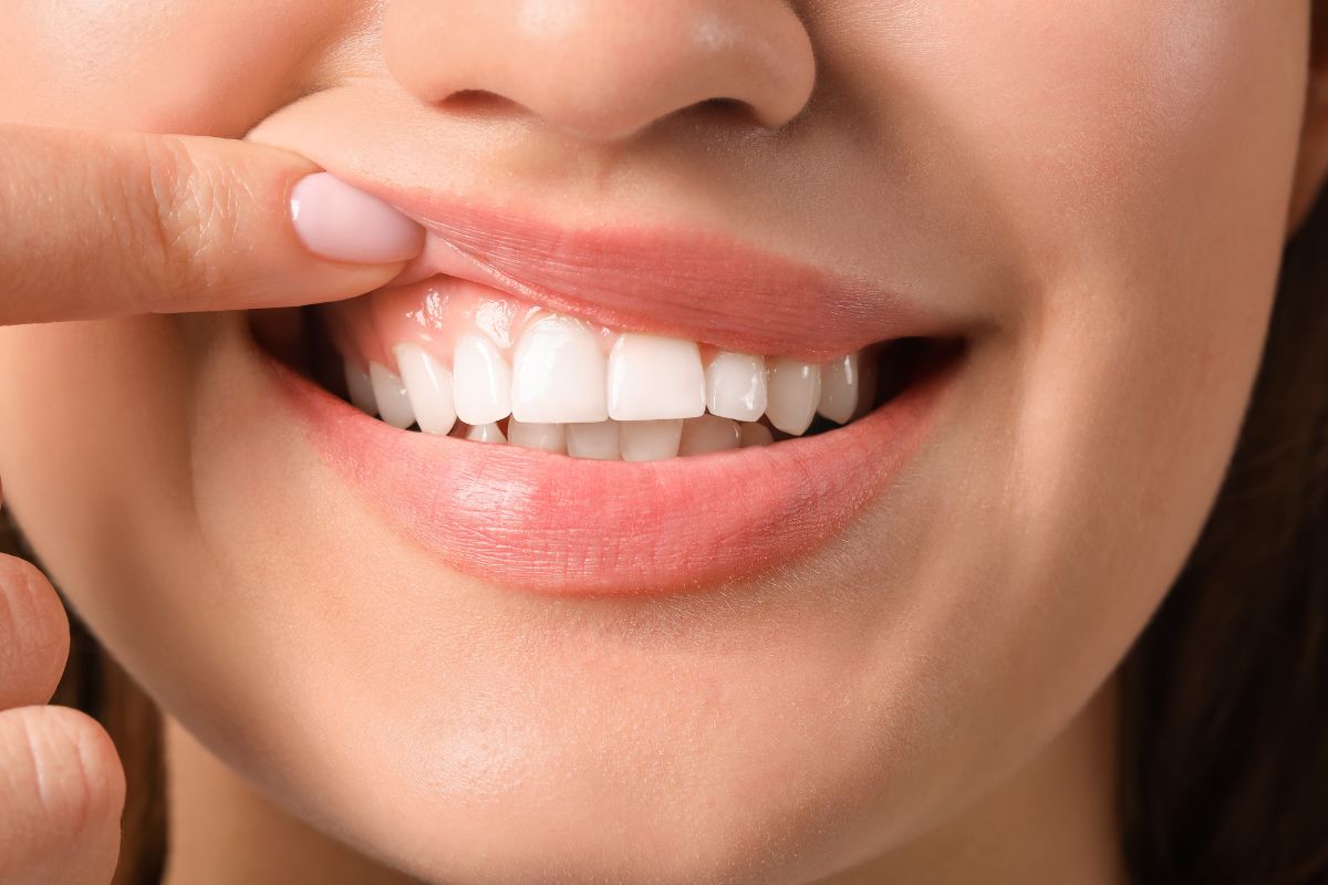 The woman checks if she has white gums.