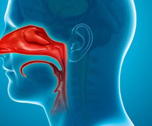 Exercise-induced rhinitis is a type of non-allergic rhinitis. The defining symptoms include nasal congestion and a runny nose that occur during or after physical activities.