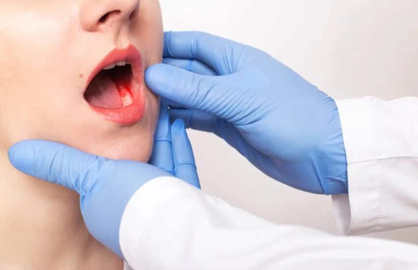bleed-gums-during-pregnancy A woman has bleeding gums during pregnancy.