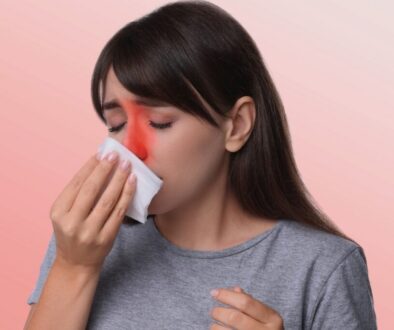 Woman with a red nose using a tissue, showing symptoms often treated with prednisone for sinus infection.